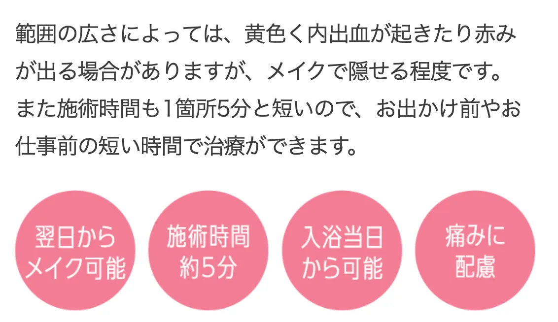 TCBのサブシジョンのダウンタイム