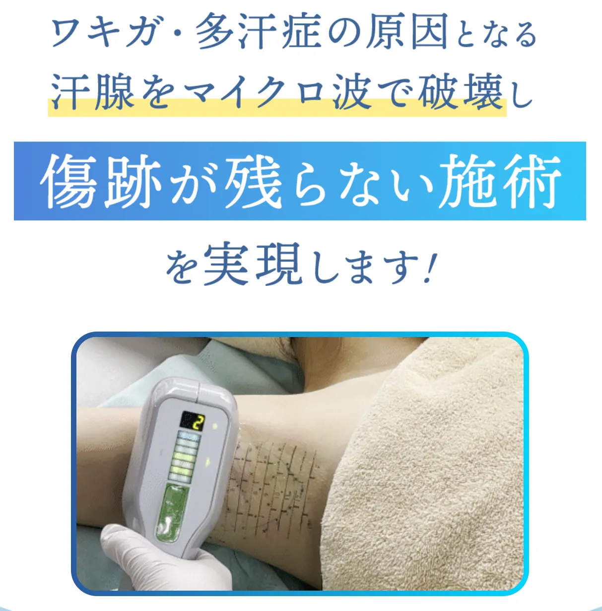 共立美容外科のミラドライは傷跡を残さず