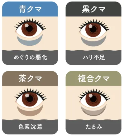 共立美容外科のクマ取りの口コミ評判!料金・目の下のたるみ取りも調査 クマの種類