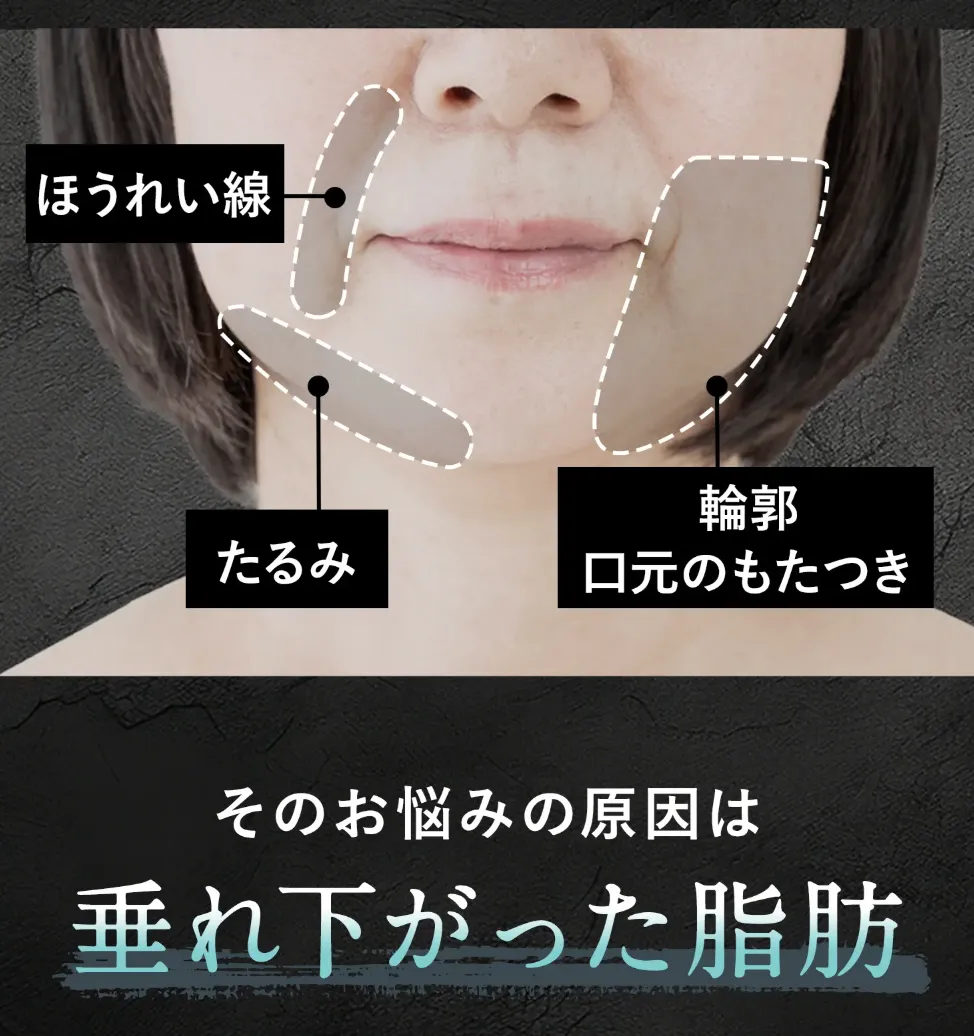 共立美容外科の糸リフトの口コミ評判!料金も徹底調査|フェイスラインの悩みの原因