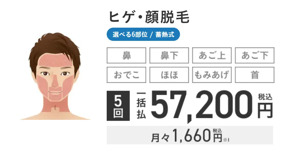 メンズエミナルのヒゲ・顔脱毛5回の蓄熱式脱毛プランの料金