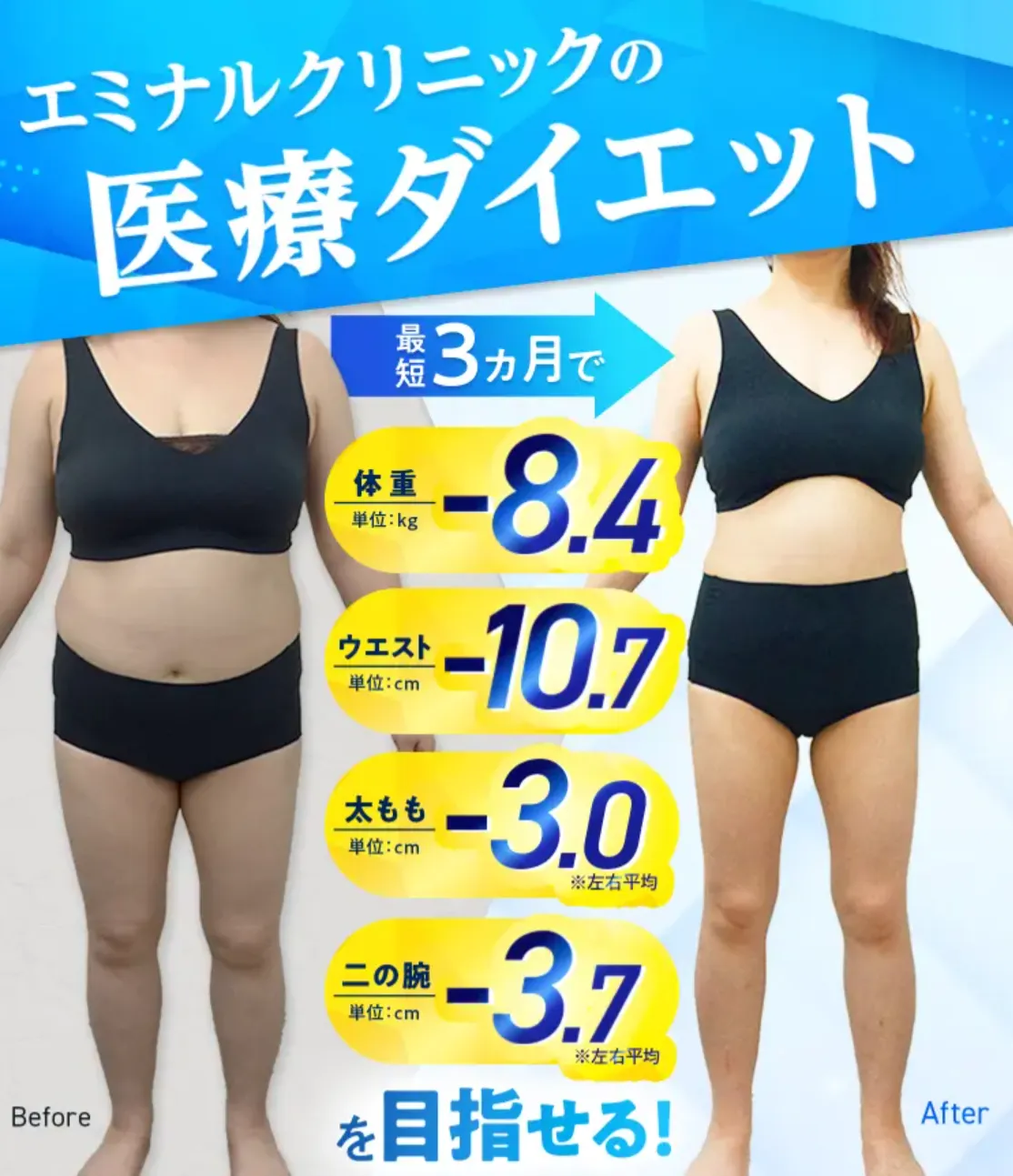エミナルクリニック 医療痩身