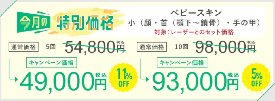 SBC湘南美容クリニックの5月の月替わりキャンペーン　エレクトロポレーション（ベビースキン）の料金①