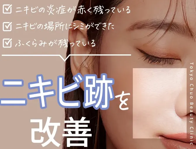 TCBのおすすめニキビ跡治療無料•0円