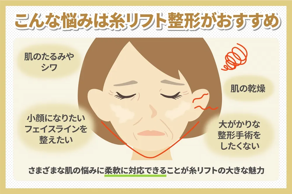 共立美容外科の糸リフトの口コミ評判!こんな悩みには糸リフト