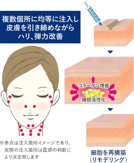 大阪でプロファイロが安いクリニックのおすすめの選び方 プロファイロの効果