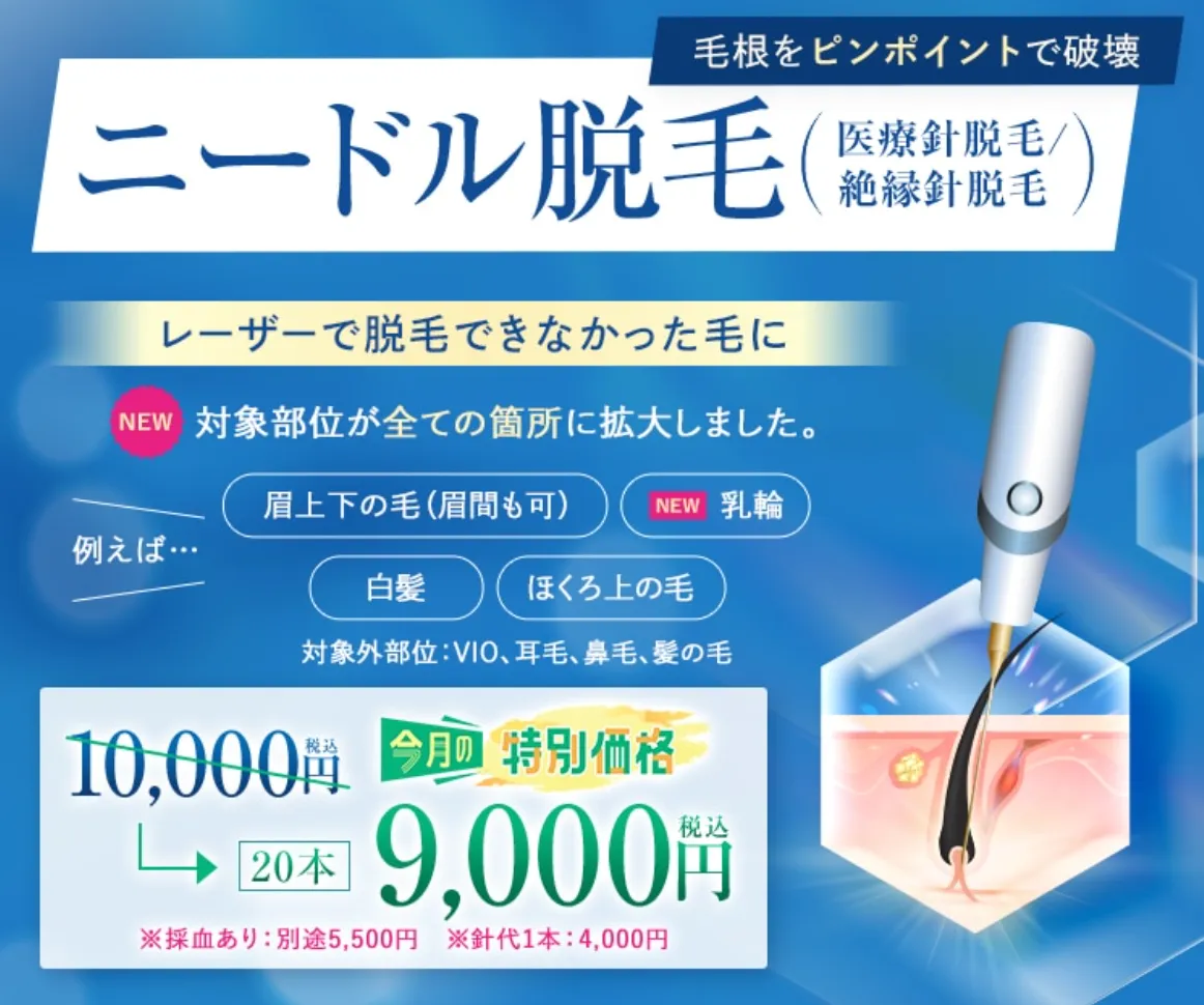 湘南美容クリニックのニードル脱毛