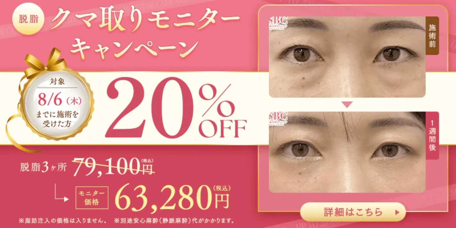 SBC湘南美容クリニックの6月の月替わりキャンペーン　クマ取り料金