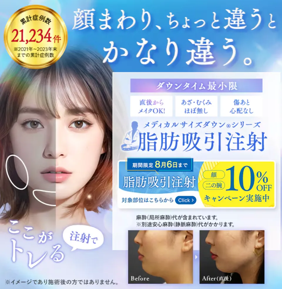 湘南美容クリニックの脂肪吸引注射