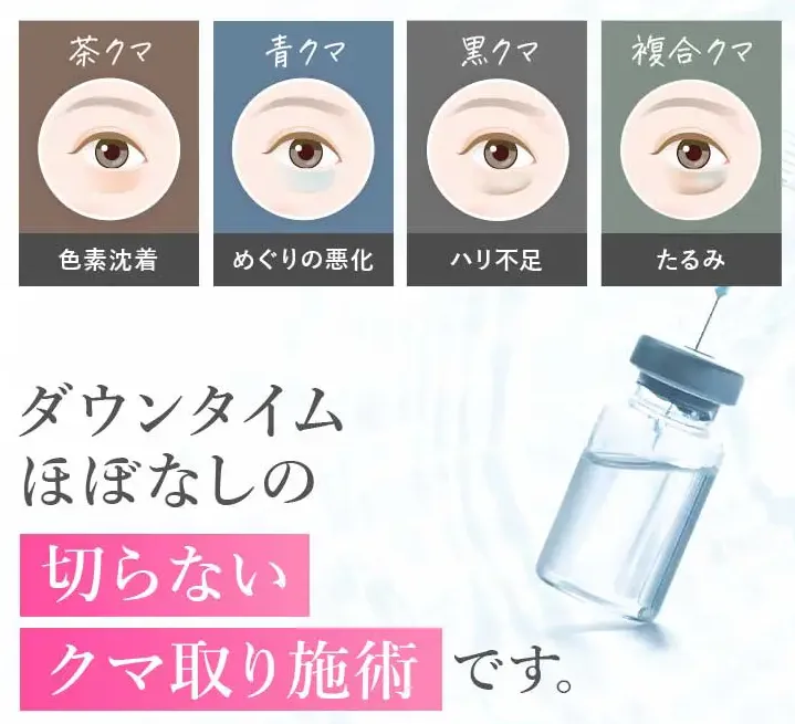 TCBのクマ取り•再生注射は失敗する?ダウンタイムはあるのか•返金制度はあるのか調査 | クマ取り注射とは
