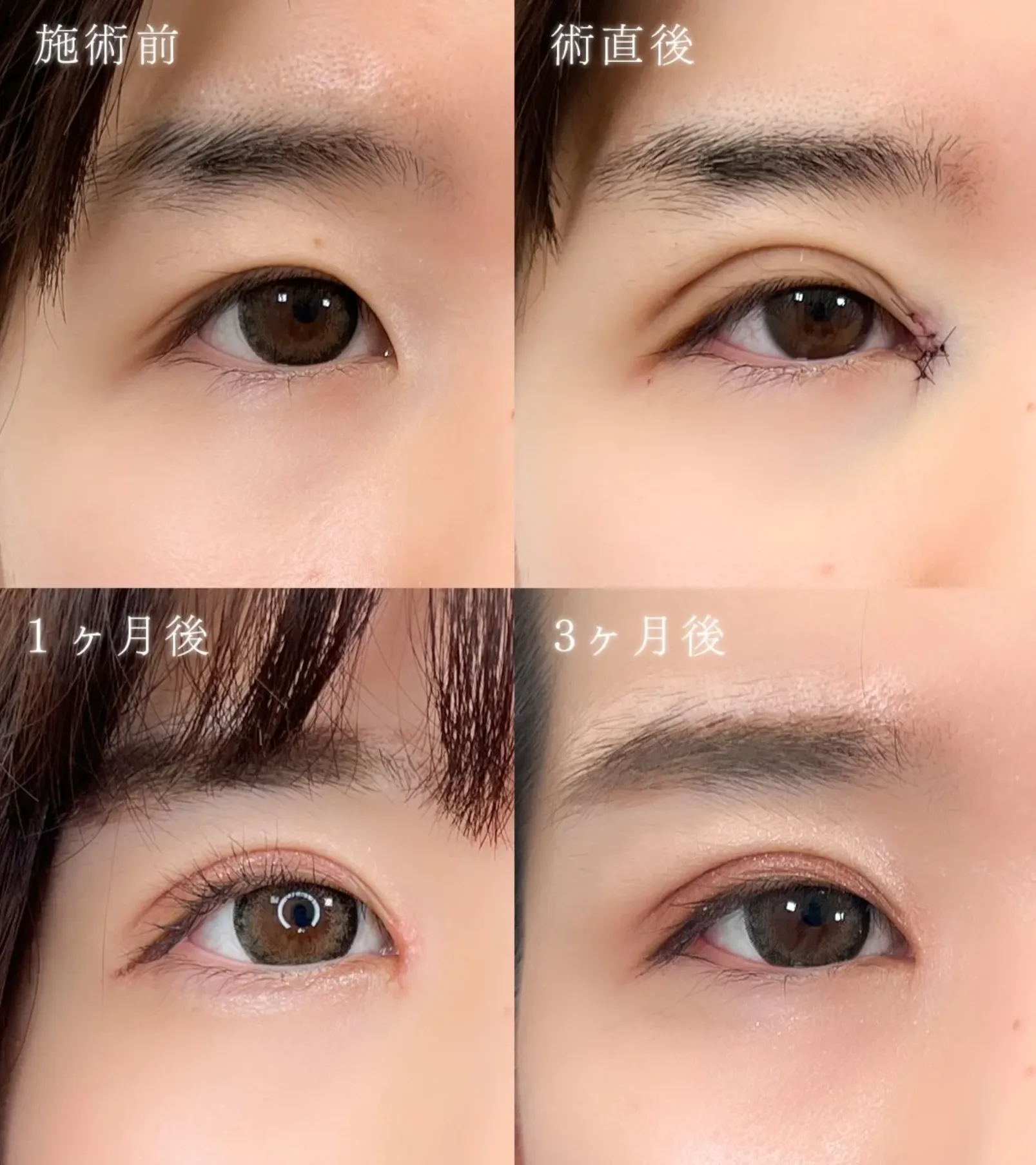 TCB村井瑞佳医師が施術した症例写真画像