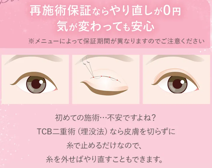TCB東京中央美容外科の二重整形プレミアムエタニティプランなら再施術保証付き