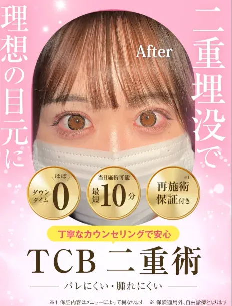 TCBで理想の二重が目指せる◎