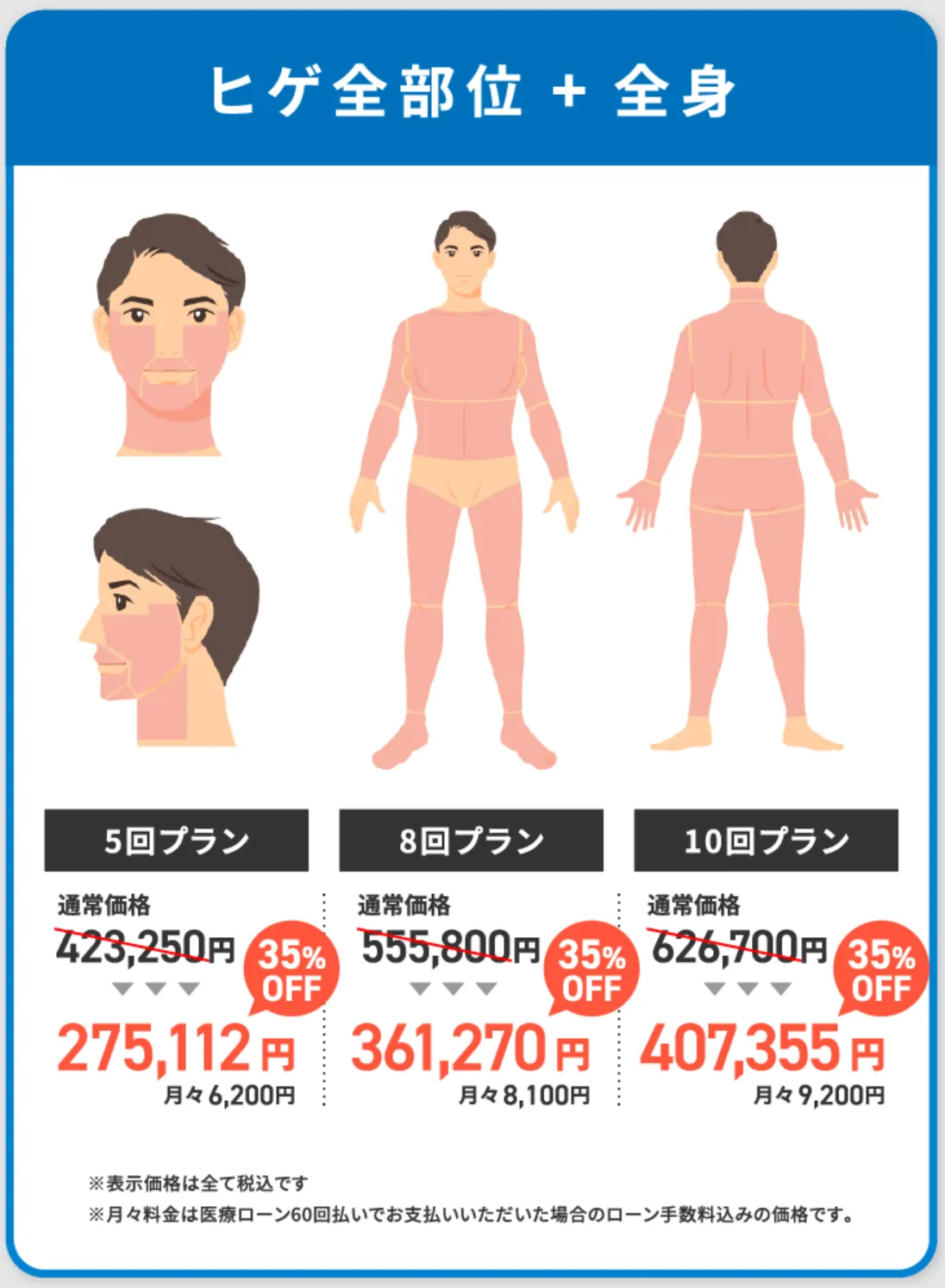 フレイアクリニックのメンズ脱毛 ヒゲ全部位+全身プラン