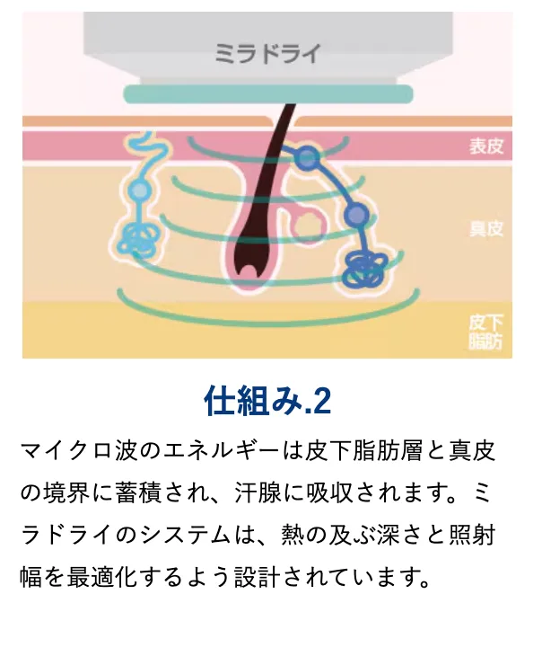 ミラドライの仕組み２