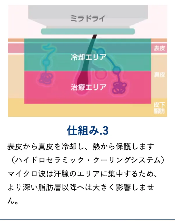 ミラドライの仕組み３