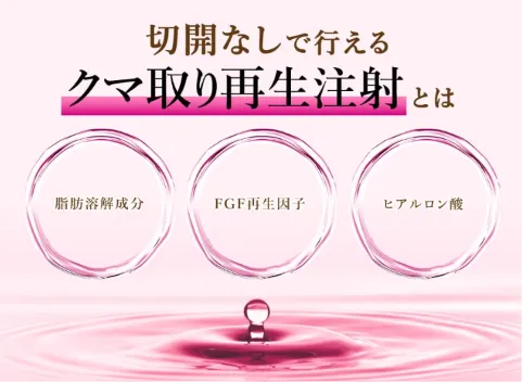 TCBのクマ取り詳細