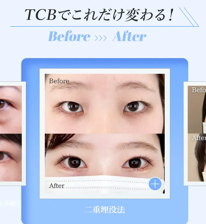 TCB倉島侑希医師の口コミ評判・経歴は?人気の理由を専門家が徹底解説 | TCBでこれだけ変わる
