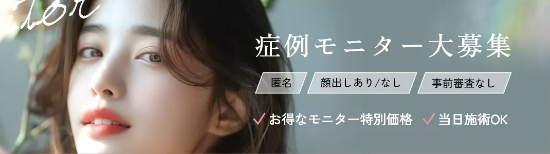 Tクリニックの脂肪吸引のモニター募集