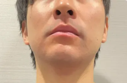 症例1-2