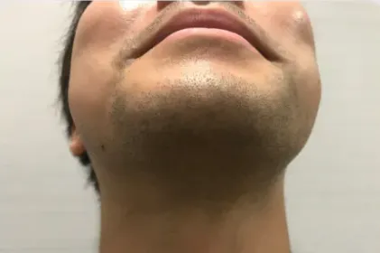 症例2-1