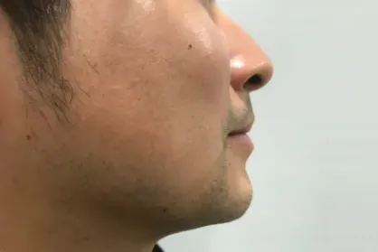 症例3-1