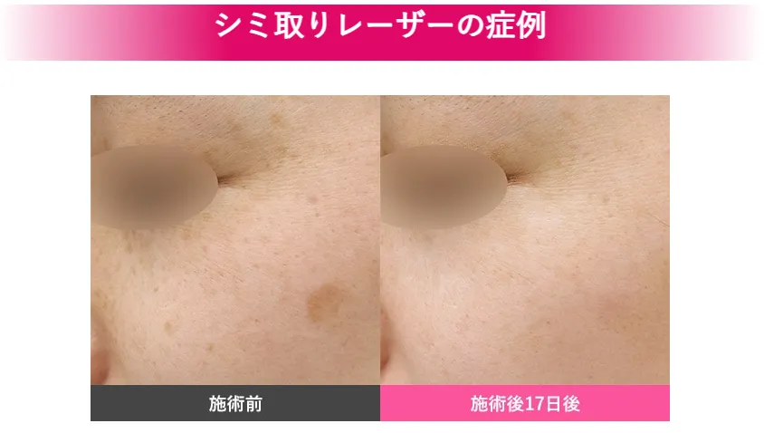 症例画像