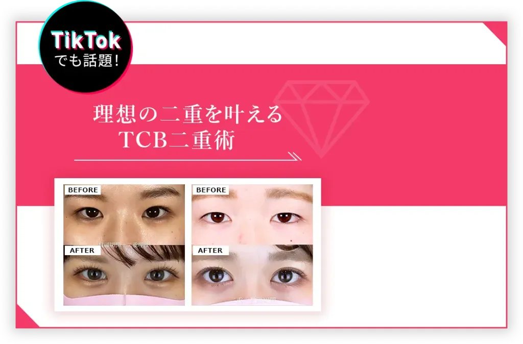 TCB東京中央美容外科　TicTokで話題