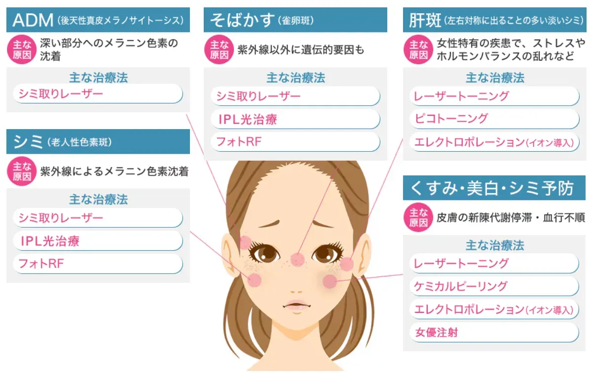 湘南美容クリニック　ピコスポット　種類別