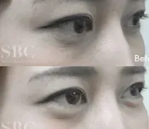 症例② before