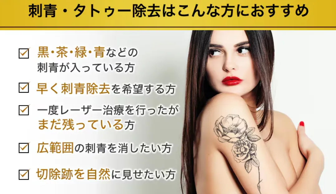 仙台で安いタトゥー除去がおすすめな湘南美容クリニックに適した方