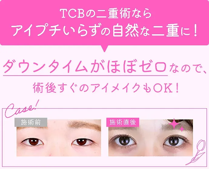 TCB東京中央美容外科の症例写真