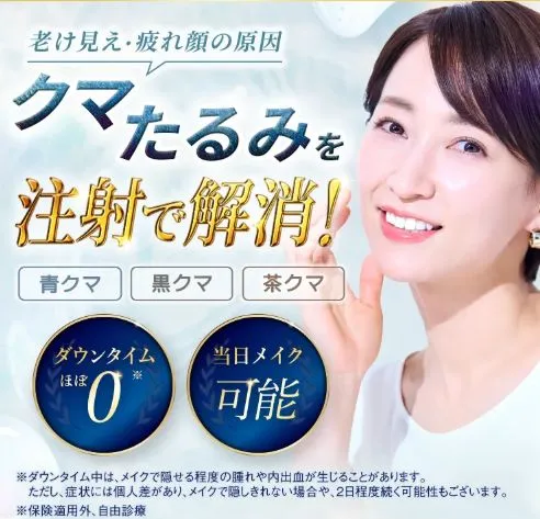 TCBのクマ取り