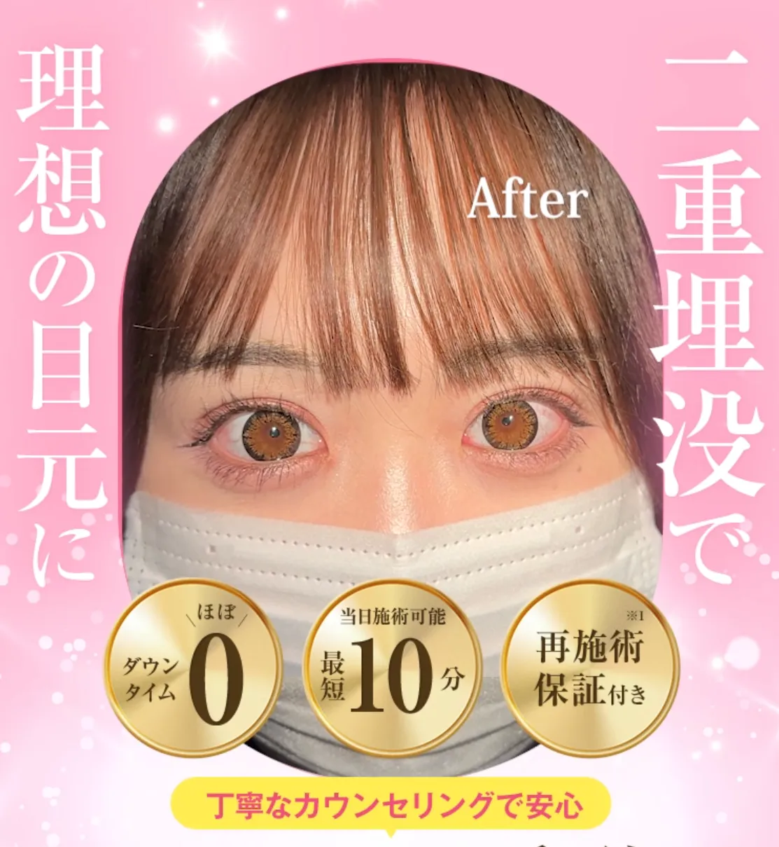 TCBの二重埋没