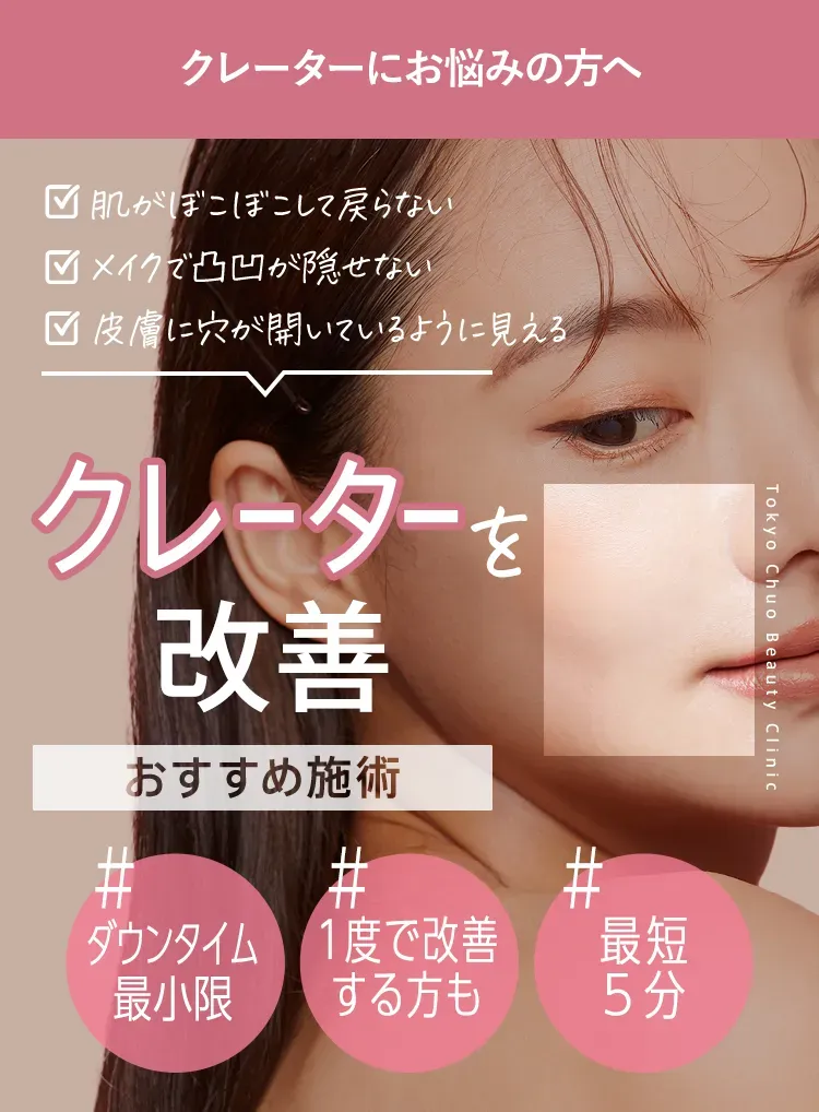 TCBのサブジジョンはダウンタイム最小限で最短5分で施術が完了