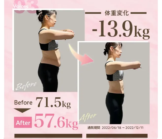 ディオクリニックの医療ダイエット症例