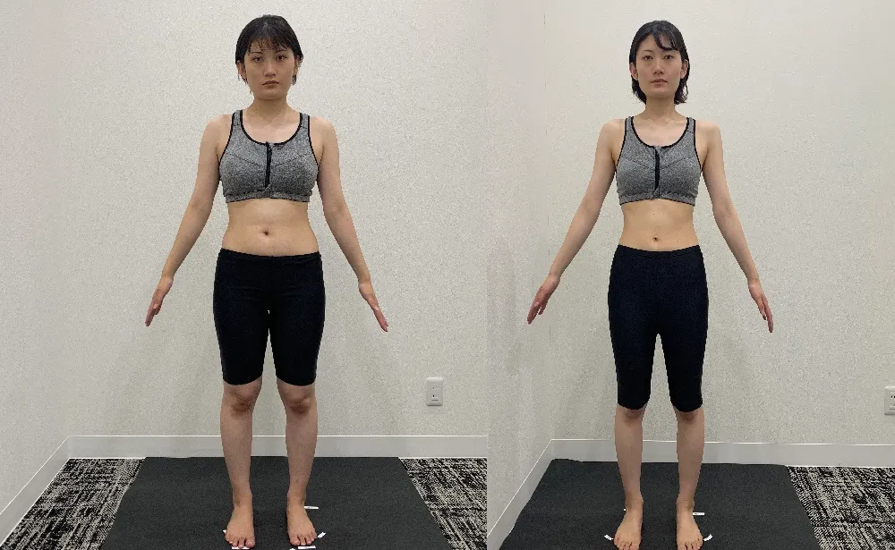 ディオの医療ダイエット5
