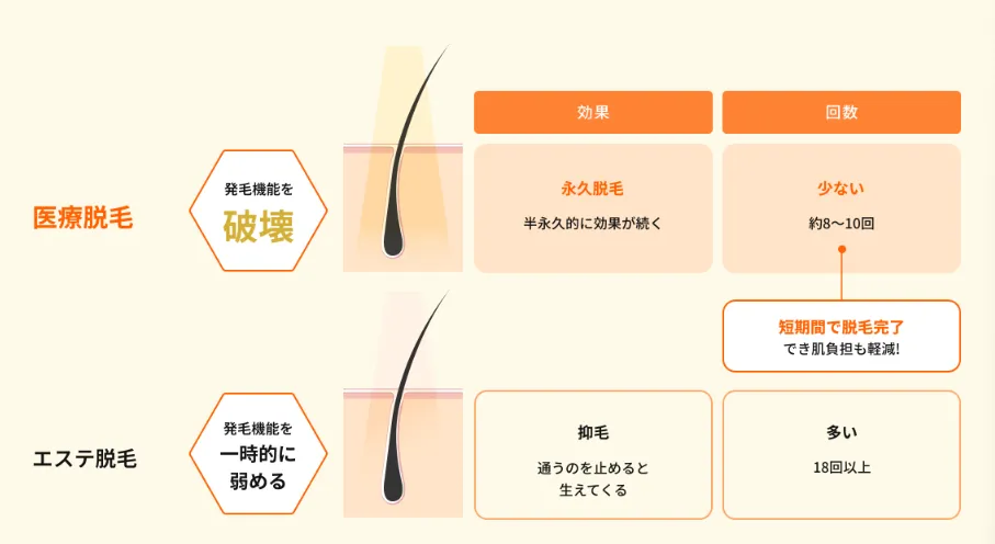 葛飾区付近のレジーナクリニックで提供している医療脱毛とエステ脱毛の違い