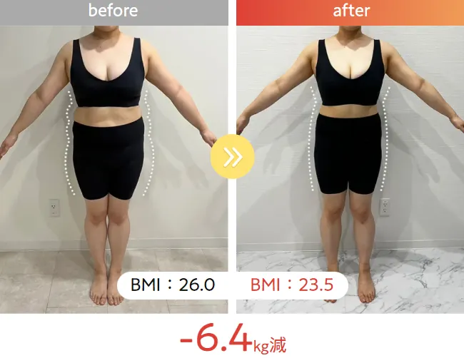 エミナルクリニック　医療ダイエット症例画像
