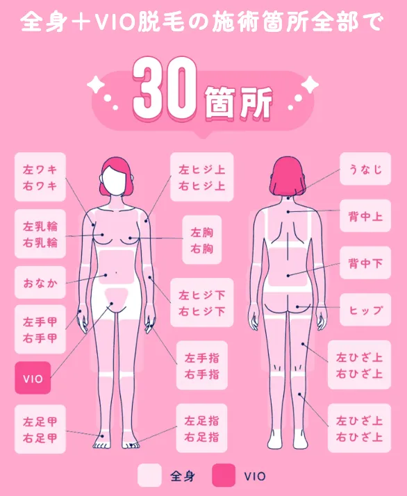 フレイアクリニックの施術箇所は全部で30箇所