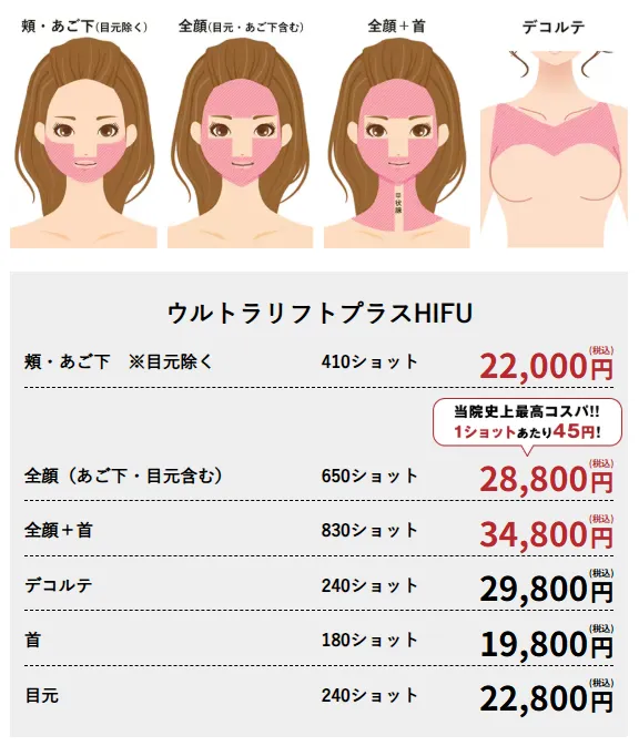 沖縄で医療ハイフの安いおすすめ人気クリニック　湘南美容クリニックの料金