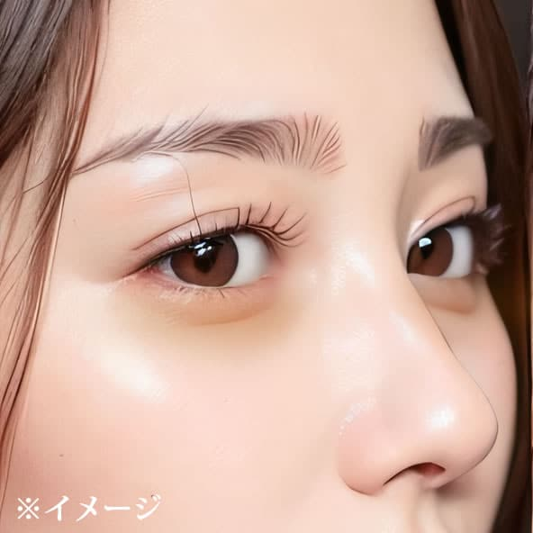 茶クマの症例写真