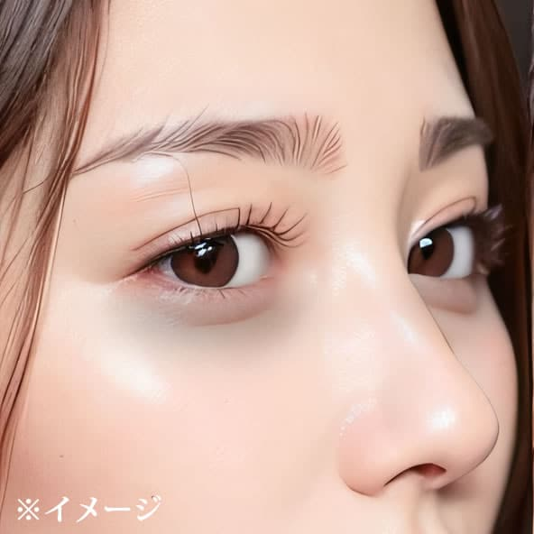 黒クマの症例写真