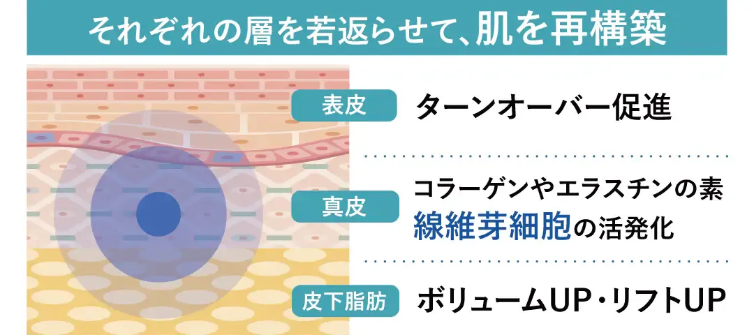 神戸で安いプロファイロがおすすめの湘南美容クリニック 肌を再構築