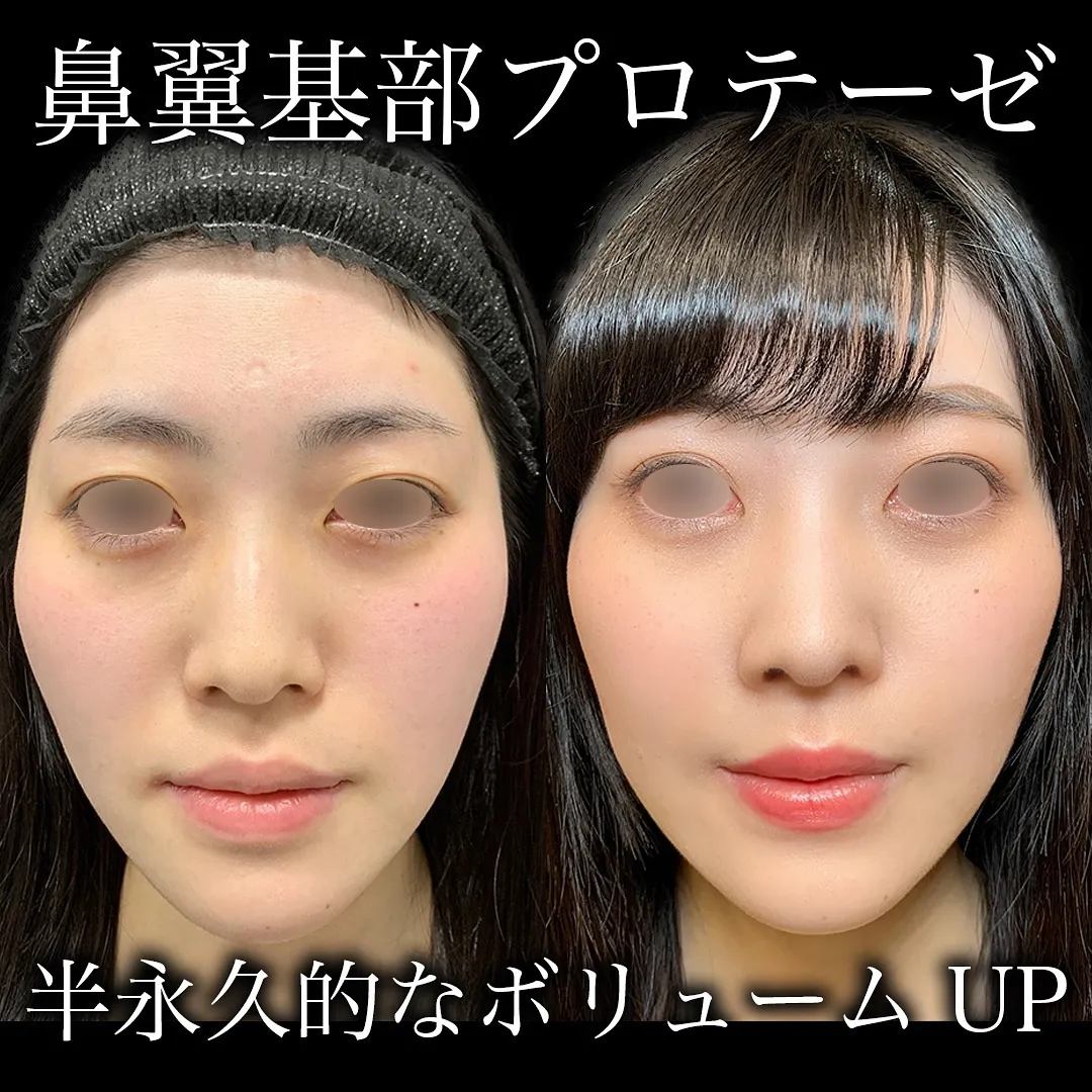eクリニックの症例写真2