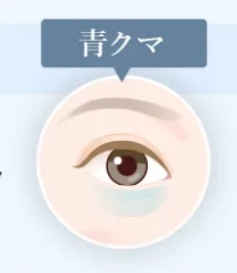 埼玉でクマ取りがおすすめのクリニック 青クマ画像