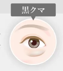 埼玉でクマ取りがおすすめのクリニック 黒クマ画像