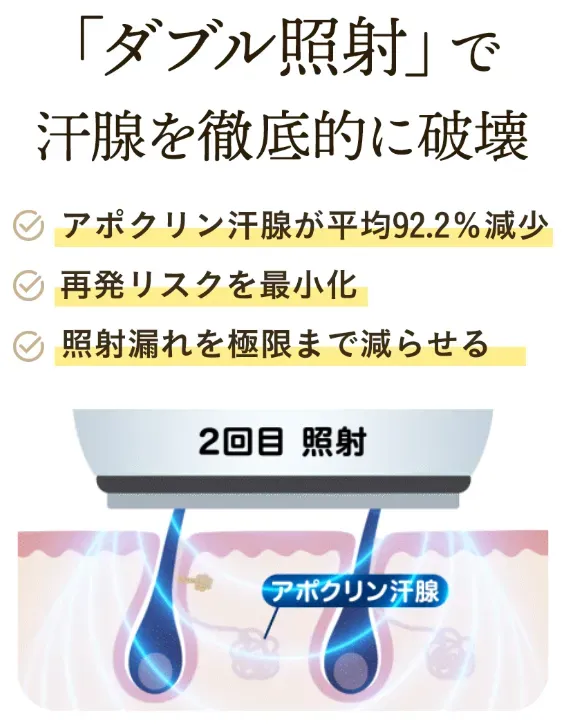 共立美容外科のダブル照射とは汗腺を徹底的に破壊する