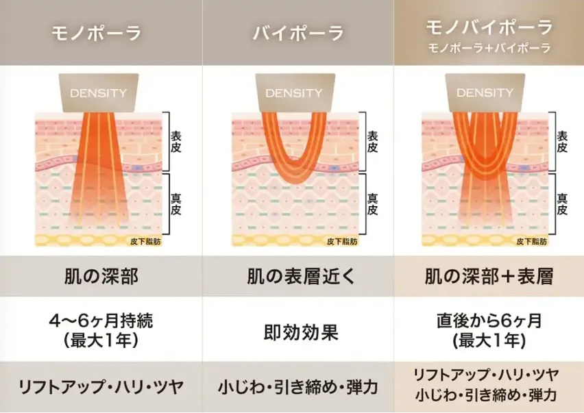 湘南美容クリニックのデンシティ施術内容　 京都　安い　おすすめ