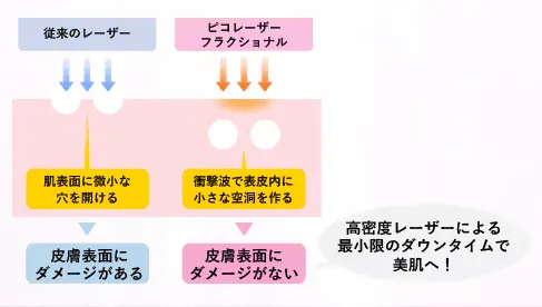 ピコフラクショナルとは